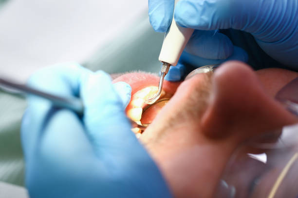 Best Broken Tooth Emergency  in Macon, IL