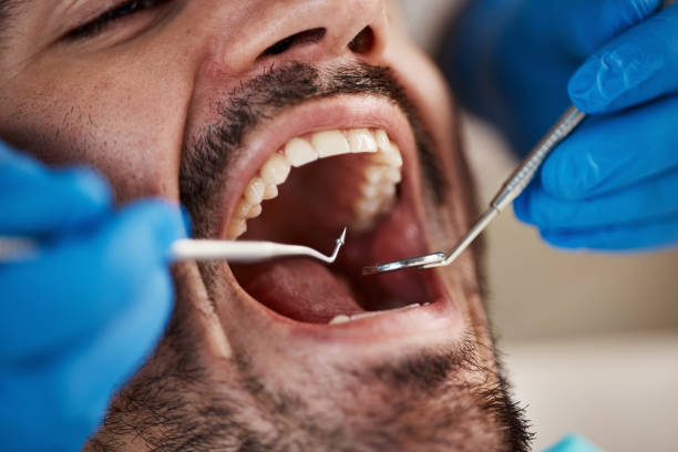 Best Cracked Tooth Emergency Dentist  in Macon, IL