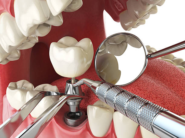 Best Root Canal Emergency Dentist  in Macon, IL